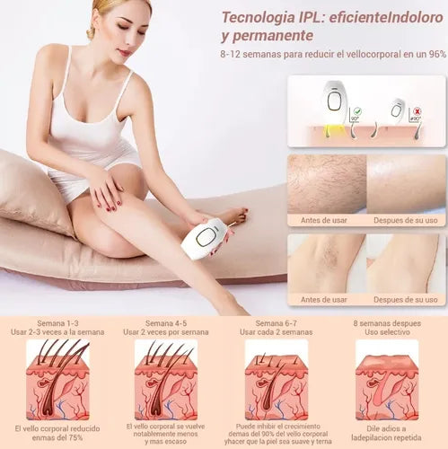 Depiladora Laser IPL